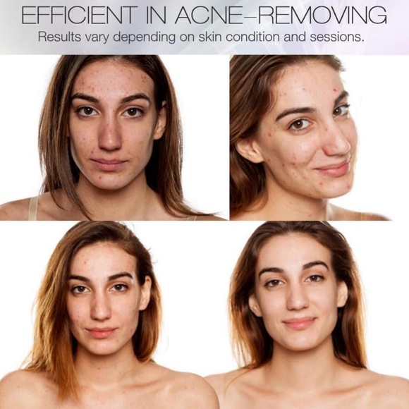 NWT LED FACIAL REJUVENATOR - Picture 3 of 8